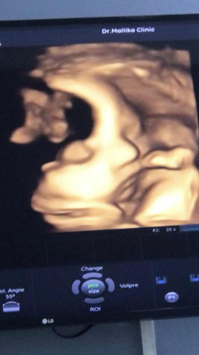 36+6week ทีมธันวา66 จะย้ายทีมมั้ยนะ