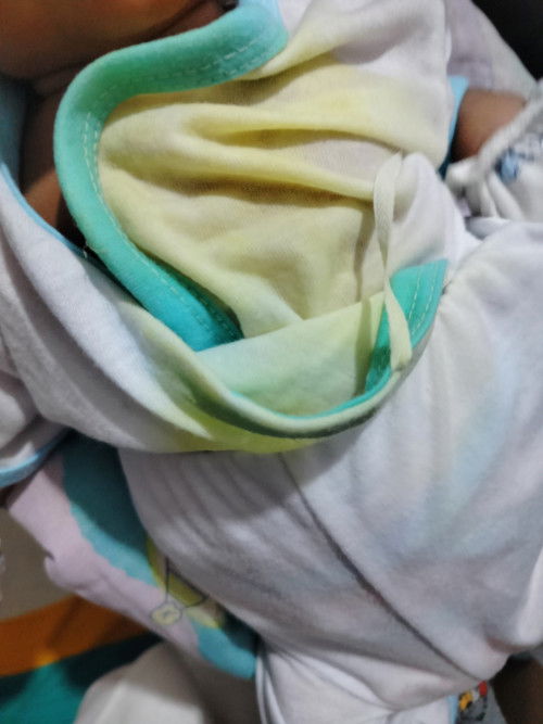 Vomitted yellow color