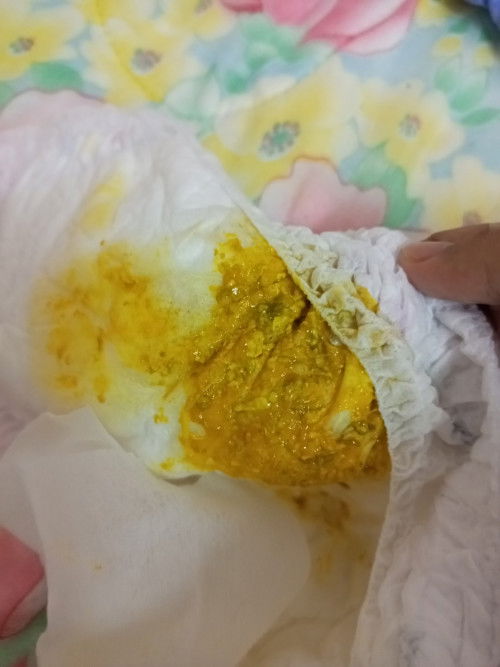 อึของลูกน้อย