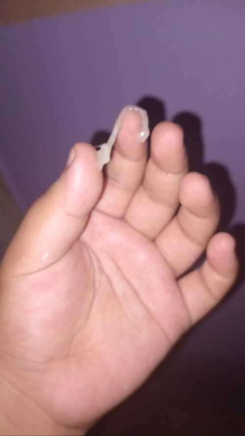 DISCHARGE at 35 weeks