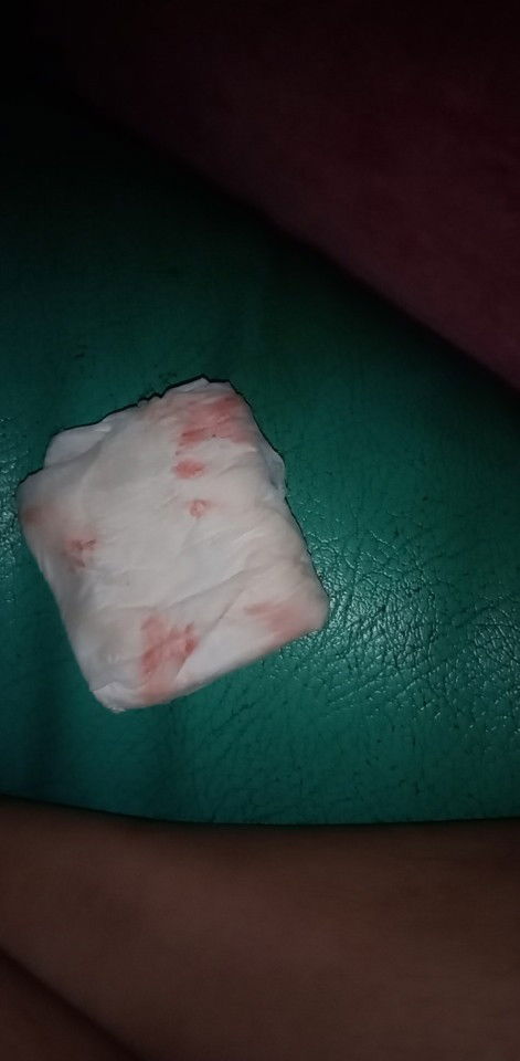 มีเลือดออกมาจากอวัยวะเพศ