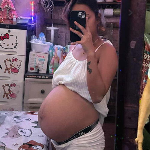 Matigas at masakit ang  tiyan @37 weeks