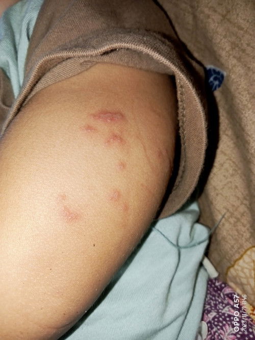 Bun ada yg tau/anaknya pernah ngalamin engga