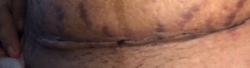 Bekas op tgl 11/11 kenapa seperti ini?