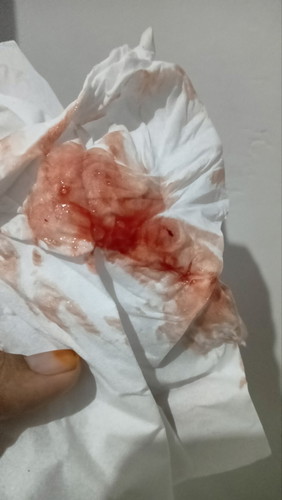 Hpl lewat 3 hari,2 hari kluar darah dan lendir hari ke 3 tdk kluar ap2 blum ad pembukaan jg 😭