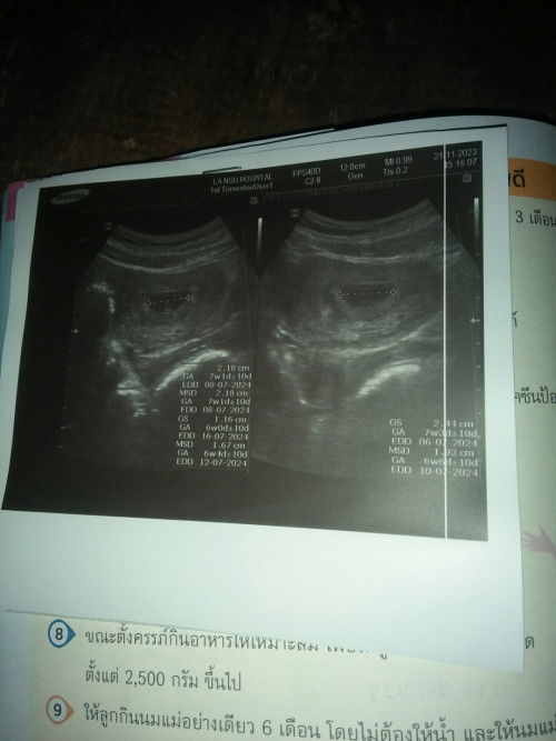 แบบนี้กี่วีคคะดูยังไงค่า?