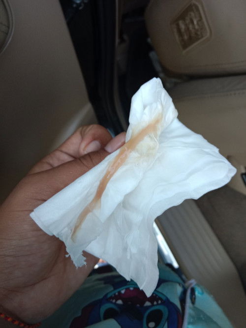 มูกอะไรหรอค่ะ