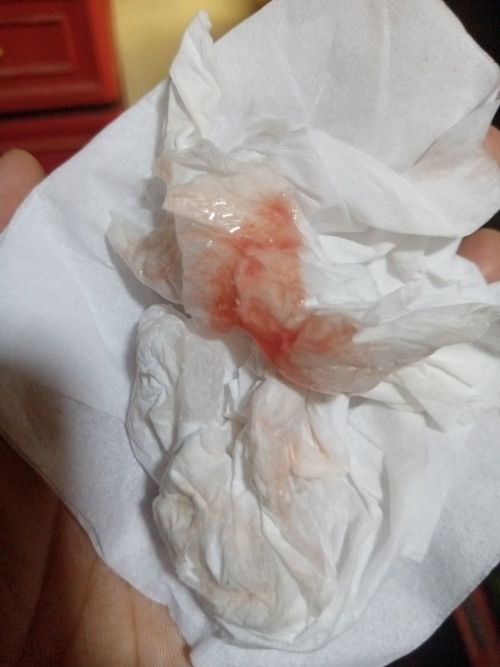 38w keluar lendir dan darah tp blm kontraksi.