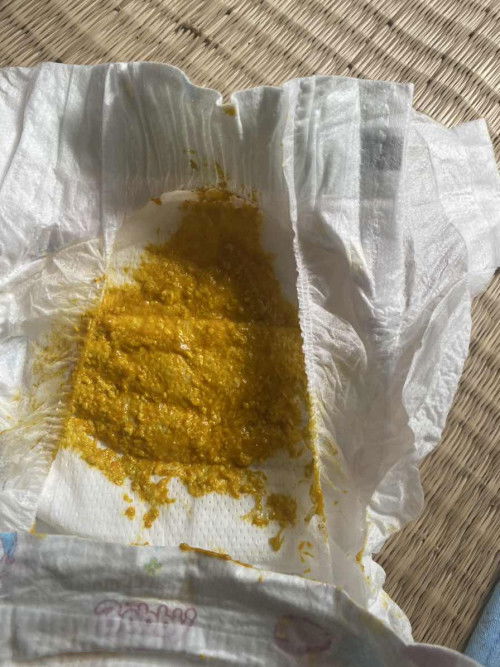 Xin lỗi vì hình ảnh nhạy cảm