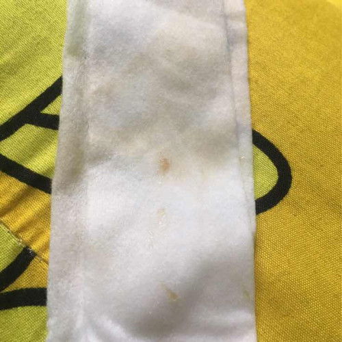 Em 37w 5day ra dịch màu nâu có phải dấu hiệu sắp sinh k ạ