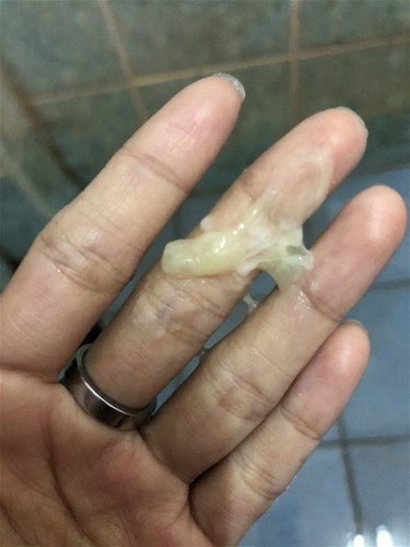 แบบนี้ใช่มูกใสไหมคะแม่ๆ