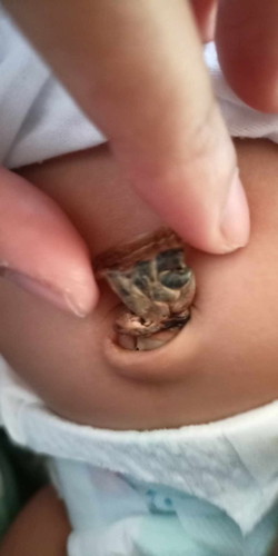 1 month and 5 days n po si baby ko.pro di p din natutuyo base ng pusod ni baby.?
