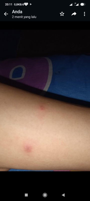 Bun ada ga ya yang kaya aku hamil tertimter ke3 tanganya pda kaya gitu.. Kira2 kenapa  yaa..