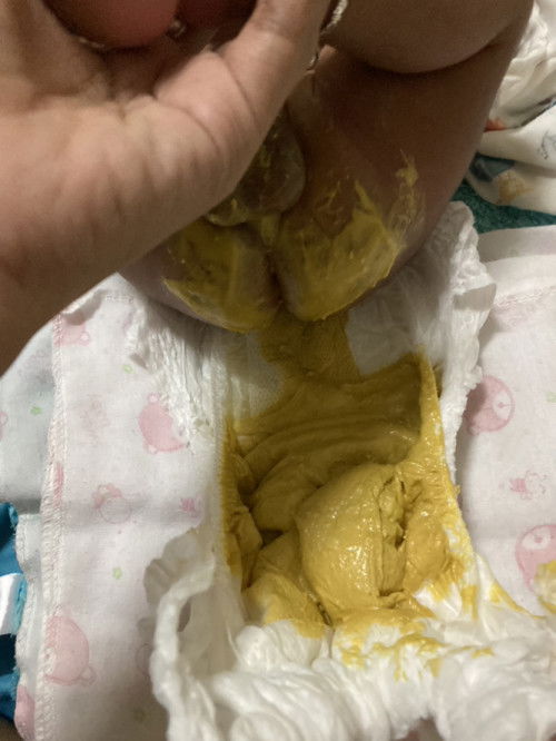 สอบถามแม่ๆ คะ