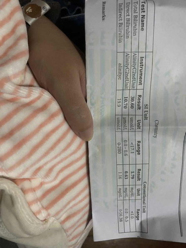 Bilirubin Test