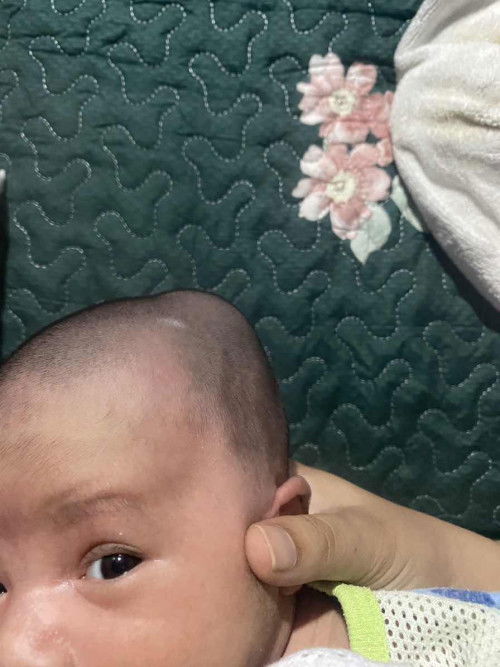 Baby 12hari : Ada caput