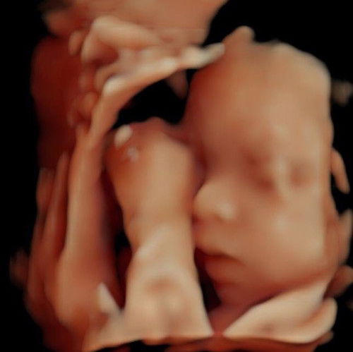 มาอวดรูปน้องๆกันค่ะ