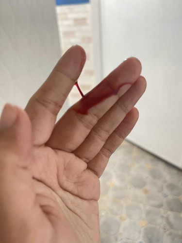 น้ำคาวปลา เลือดหลังคลอด
