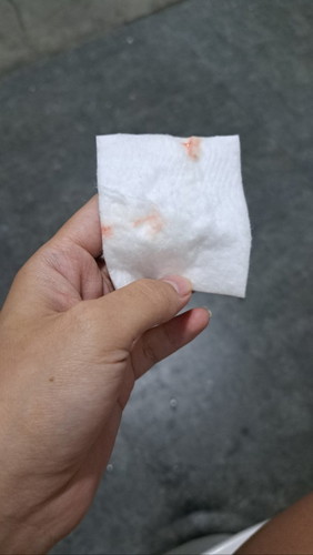 แม่ๆคะมีมูกแบบนี้ควรไปรพ.เลยมั้ยคะยังไม่มีอาการปวดร่วมด้วย
38w