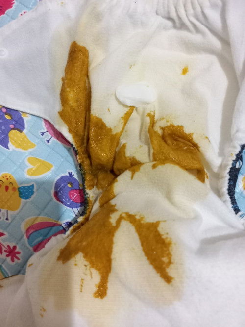 BAB bayi 1 bulan 10 hari