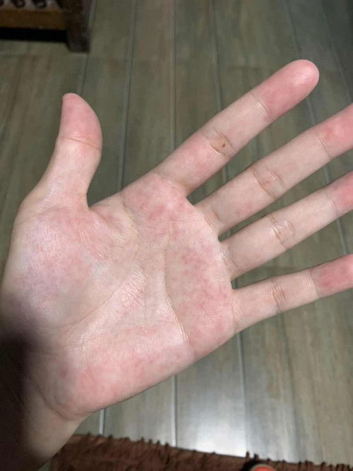 Makati at may pula pula