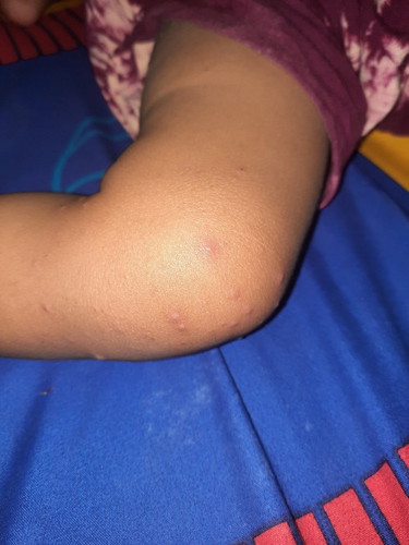 Mohon info di beberapa bagian anak saya muncul seperti ini, kenapa ya? Mohon infonya