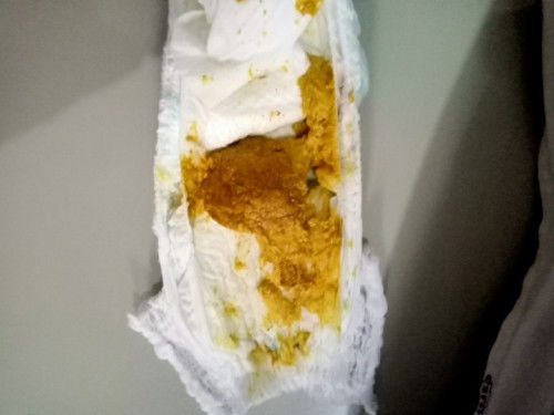 Fases bayi tidak pup 5 hari