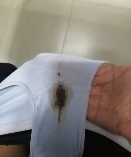 Brown Discharge