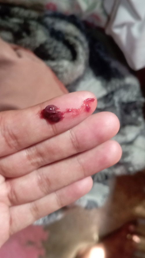 asking po if mucus plug po ba to?