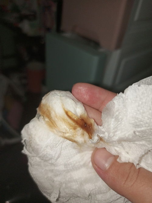 Brown discharge 1 cm 37 weeks