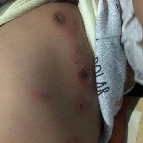 Permasalahan kulit bayi