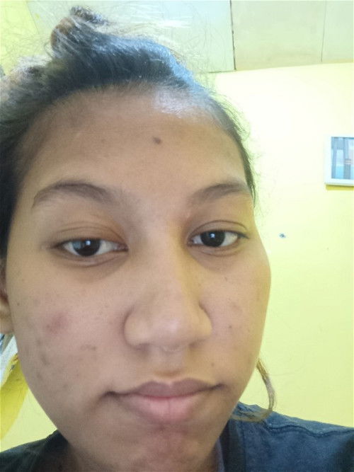 Perbedaan hamil anak pertama sma kedua