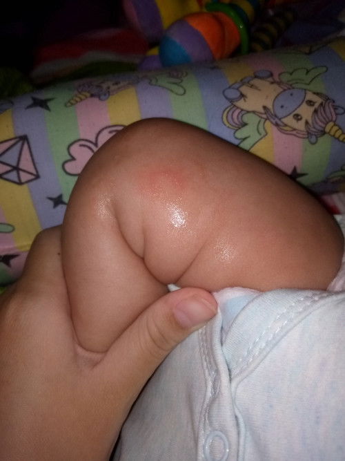 แนะนำการรักษาเชื้อราเเมวในเด็ก3เดือนหน่อยค่ะ