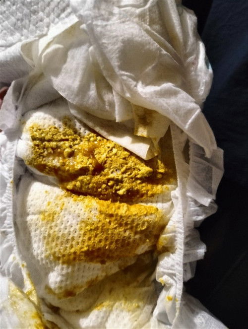 Bayi berak 6 kali sehari dan berlendir