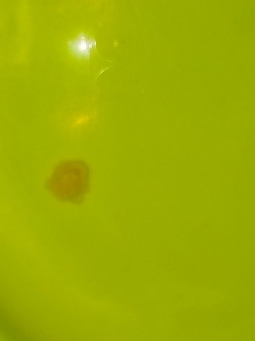 Normal lng kaya to, parang every month may ganito ako. Mataas din pala uti ko. Nagurine culture ako