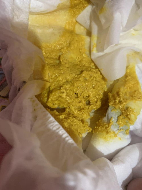 Ftm , ask lang po if normal lang po ung poop ni lo and mga ilang days narin Po sya my sipon