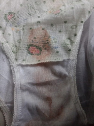 Implantation bleeding ba ito?