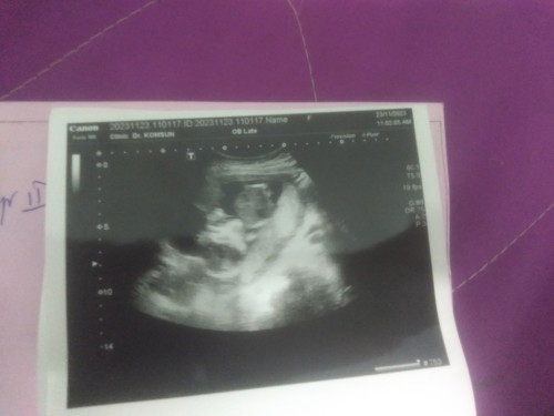 ท้องแรกทีมพฤษภาคม67