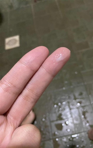 KEPUTIHAN TANDA PERIOD ATAU HAMIL