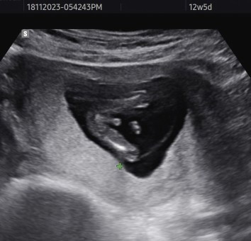 Please ...Ni gambar gender ke?