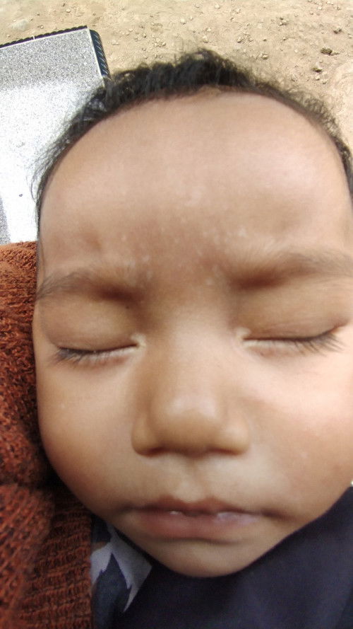 Putih putih di jidat, dan mata