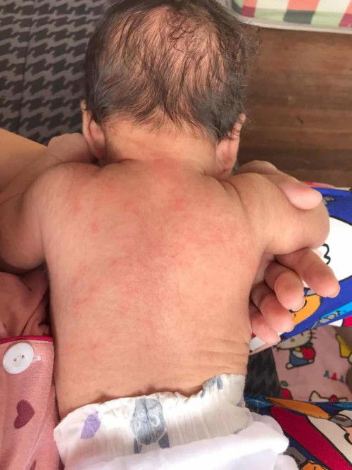 Ano po kaya pede igot