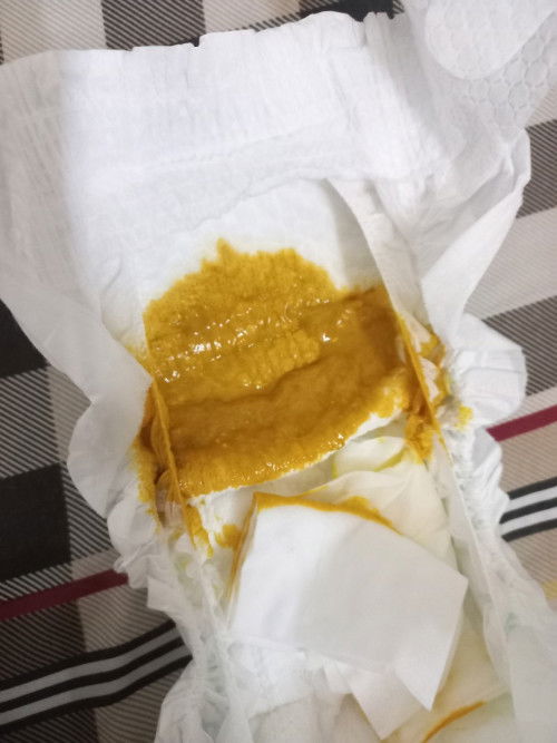 Bé nhà em đi phân có mùi hơi chua và nhầy bé em 2m23d