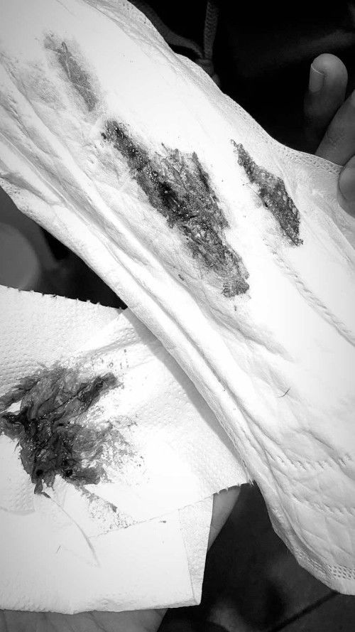 INSYA ALLAH AKU IKHLAS 💔