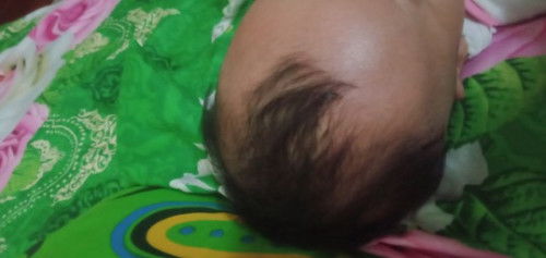Rambut bayi 3 bulan