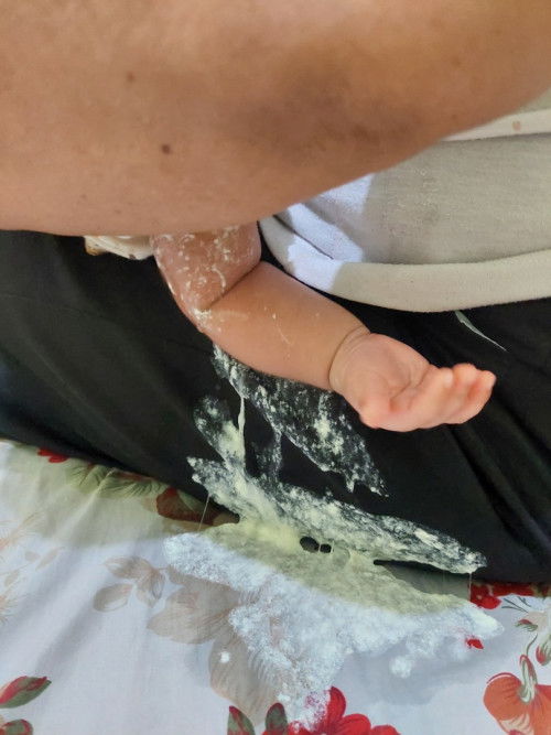 Bayi 1 bulan muntah atau gumoh?