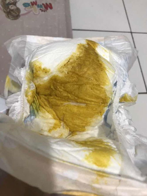 Fases bayi 1 bulan 29 hari