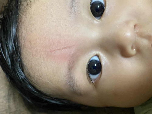 Perlu ke klinik atau tak?