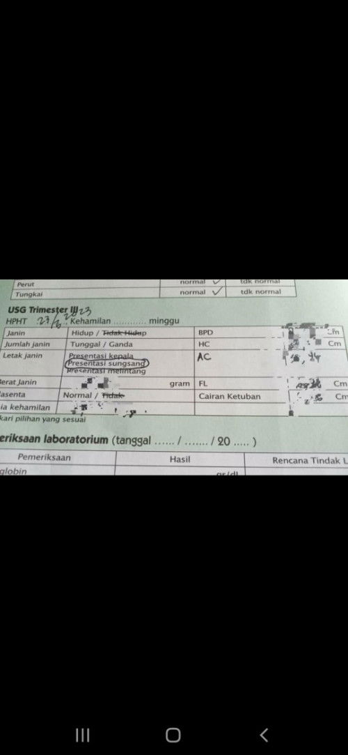 Bun adakah yang sudah hamil 34 minggu lebih 2 hari bayinya sungsang?