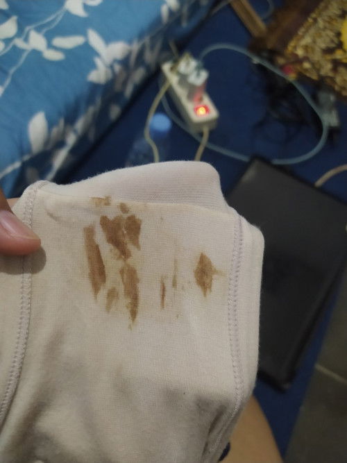 Flek coklat usia 10 minggu 4 hari